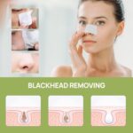 چسب بینی سرسیاه لانبنا-Lanbena nose plants pores strips