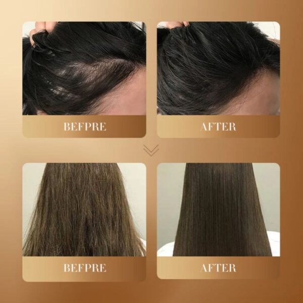 شامپو زنجبیل ضد شوره سادور