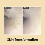 کرم دور چشم 9 پپتید و هیالورونیک جوانساز مدی پیل-MEDIPEEL 9 PEPTIDE & hyalo acid  volomy eye cream