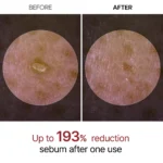 پیلینگ شات برنج دکتر ملاکسین-DR.MELAXIN Peel Shot Glow White Rice Ampoule