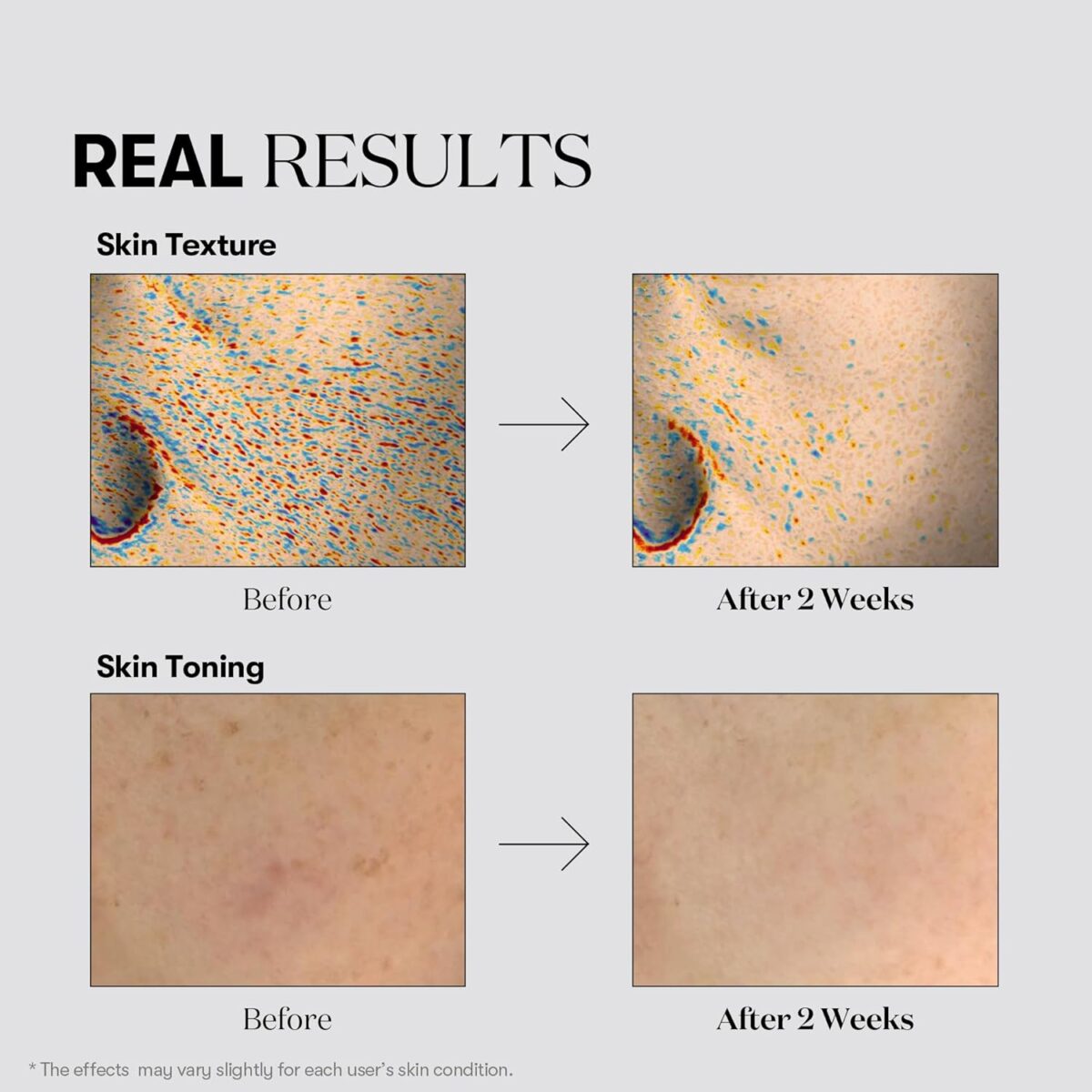 تونر پوست شیشه ای و تقویت کننده وی تی-VT COSMETICS TX Toning Facial Toner