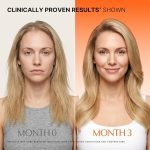 سرم اسکالپ محرک رشد مو لیلیوئه lilyeve GROWTURN Hair Growth Serum - Image 12