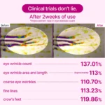 پچ زیر چشم ضدلک و پف کلسیوم دکتر ملاکسین Dr Melaxin Cemenrete Calcium Volume Eye patch - Image 2