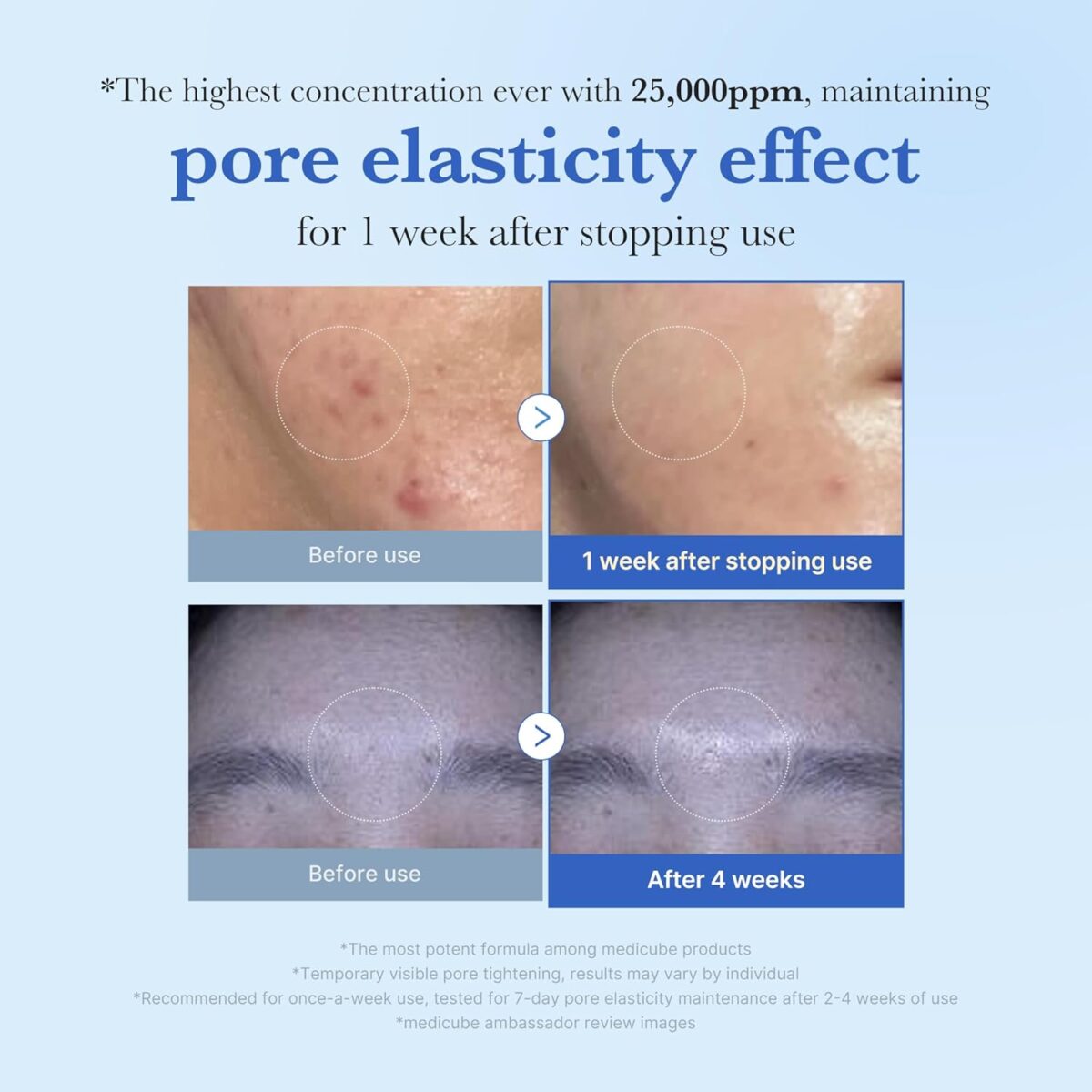 شات 25000 رفع منافذ و ضدجوش مدی کیوب Medicube one day shot exosome 25000 - Image 9