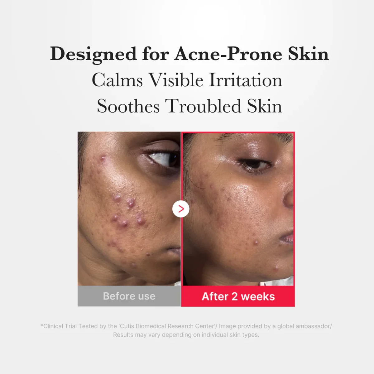 اسپری ضدجوش و تسکین دهنده مدی کیوب medicube Hypochlorous Acid Daily Facial Spray - Image 6