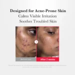 اسپری ضدجوش و تسکین دهنده مدی کیوب medicube Hypochlorous Acid Daily Facial Spray - Image 6