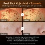 ست پیلینگ شات کوجیک اسید و زردچوبه صورت بدن و پا دکتر ملاکسین - Image 10
