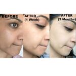 صابون ضدلک و روشن کننده کوجیک اسید صورت و بدن کوجی سان Kojie San Skin Lightening Kojic Acid Soap - Image 5