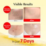 کرم ویتامین سی ضدلک و درخشان کننده اکوال بری EQQUALBERRY Vitamin Illuminating Cream - Image 9