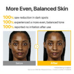 سرم گلوتاتیون و Txa ضدلک و روشن کننده قوی نامبوزین nubbuzin n5 glutathione txa dark spot ampoule concentrate - Image 8