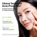 مرطوب کننده آزلایک اسید ضد التهاب قرمزی آنوا ANUA AZELAIC ACID CICA SKIN SOOTHING MOISTURIZER - Image 6