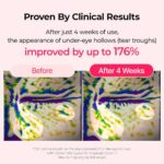کرم کلسیوم ضدلک و احیا پوست دکتر ملاکسین Dr.Melaxin CALCIUM CYANO PINK SPICULE CREAM - Image 8