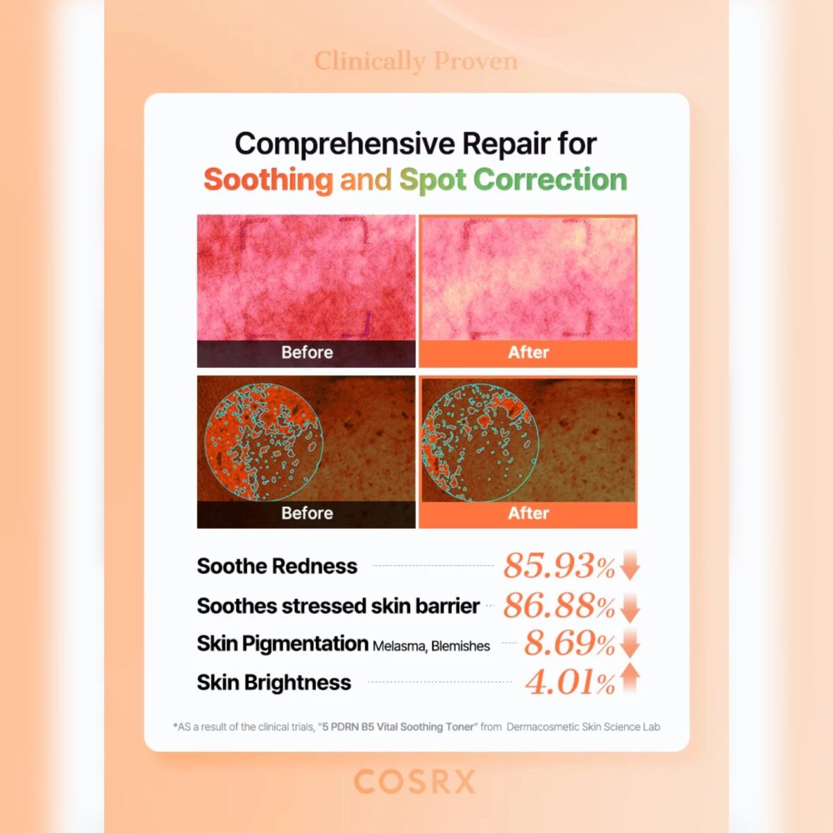 تونر 5 PDRN احیا و درخشان کننده کوزارکس COSRX 5PDRN B5 VITAL SOOTHING TONER - Image 8