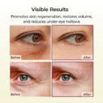 بالم ضدچروک و جوانساز قوی کلسیوم صورت و چشم دکتر ملاکسین DR.MELAXIN CEMENRATE CALCIUM MULTI BALM - Image 8