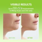 ماسک کاکتوس لیفت غبغب و ضد پف کلاژن و کافئین دکتر ملاکسین Dr.Melaxin CACTOX V-Lifting Mewing Band - Image 2