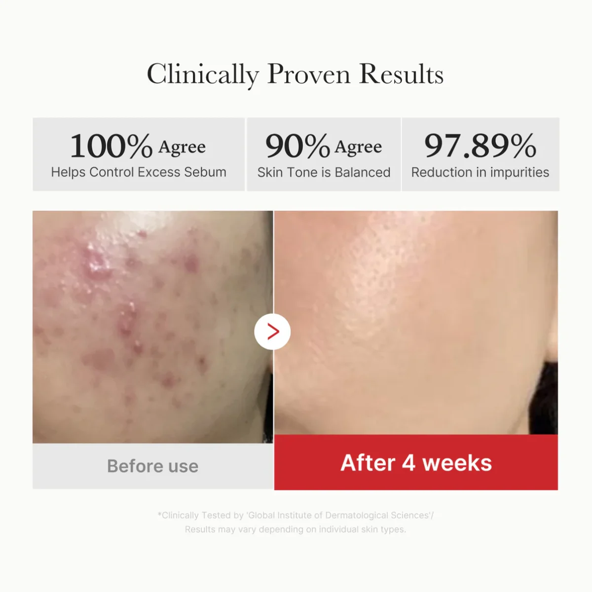 تونر پد ضدجوش و التهاب سوکسینیک اسید مدی کیوب MEDICUBE Red Succinic Acid Panthenol Pads - Image 6