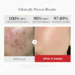 تونر پد ضدجوش و التهاب سوکسینیک اسید مدی کیوب MEDICUBE Red Succinic Acid Panthenol Pads - Image 6