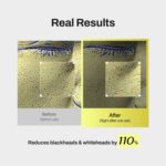 تونر پد نیاسین امید مدی تراپی پاکسازی و کاهش منافذ MEDITHERAPY Niacin X BHA Pore Mild Clear Toner Pad - Image 6
