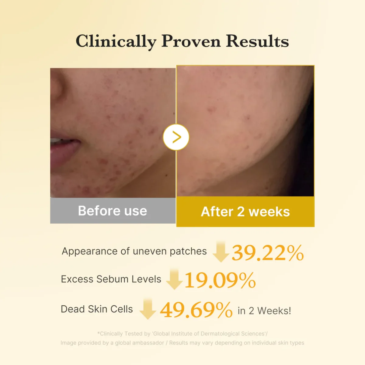 تونر پد کوجیک اسید و زردچوبه ضدلک تیره و روشن کننده مدی کیوب MEDICUBE Kojic Acid Tumeric Toner Pad - Image 5