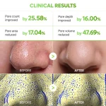 پک ماسک بینی 3 مرحله کاکتوس دکتر ملاکسین DR.MELAXIN CACTOX 3-Step Nose Mask Pack - تصویر 5