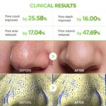 پک ماسک بینی 3 مرحله کاکتوس دکتر ملاکسین DR.MELAXIN CACTOX 3-Step Nose Mask Pack - Image 5