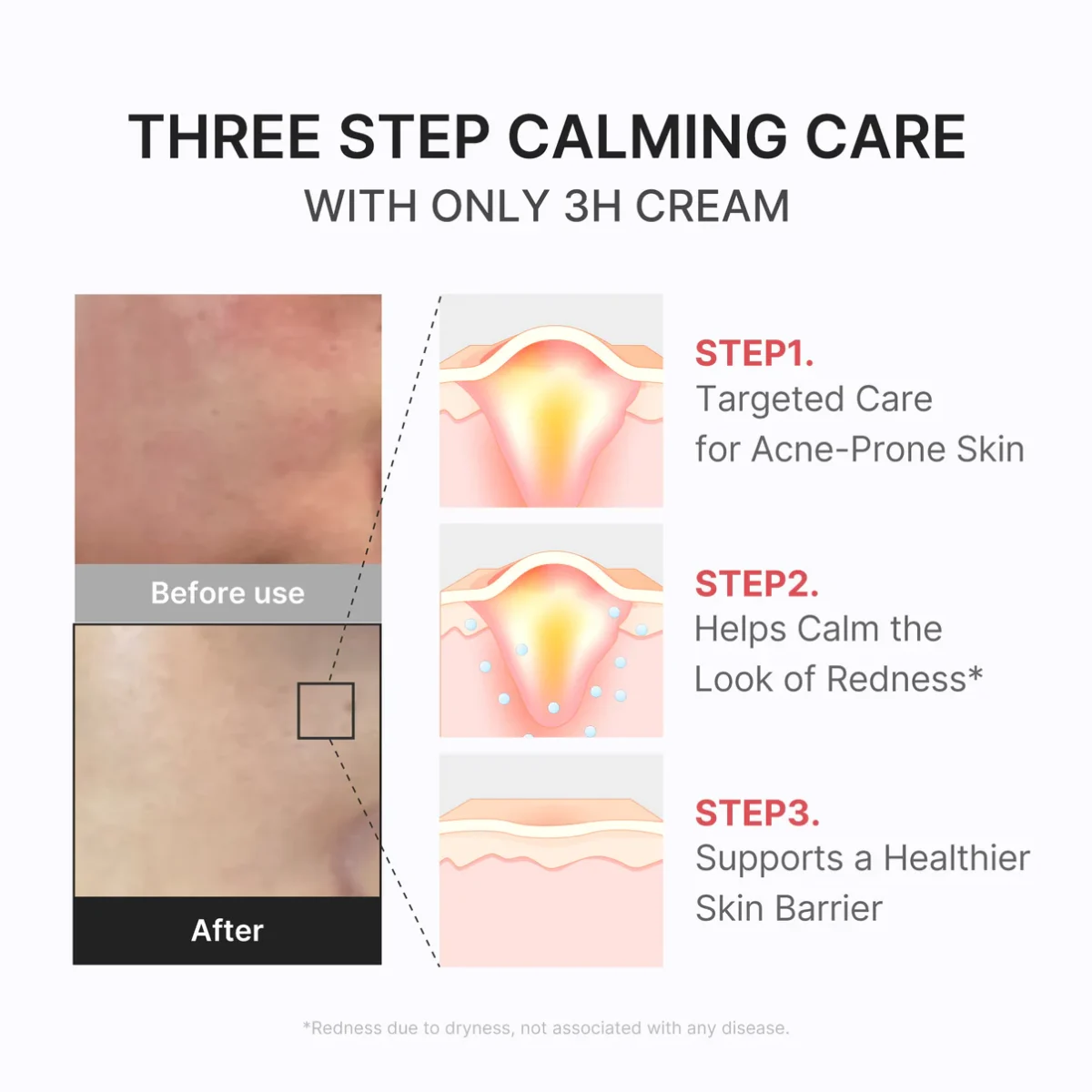 کرم ترمیم کننده و احیا پوست 3 ساعته مدی کیوب MEDICUBE 3H Daily Relief Cream - Image 6