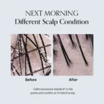 آمپول تخصصی تقویت اسکالپ گروس رفع پوسته و احیا GROWUS Damage Therapy Scalp Scaling Ampoule - Image 8
