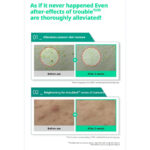 اسکراب اکنه کنترل و لایه بردار بدن ایلیون ILLIYOON AC CLEAR BODY PEEL SCRUB - Image 13