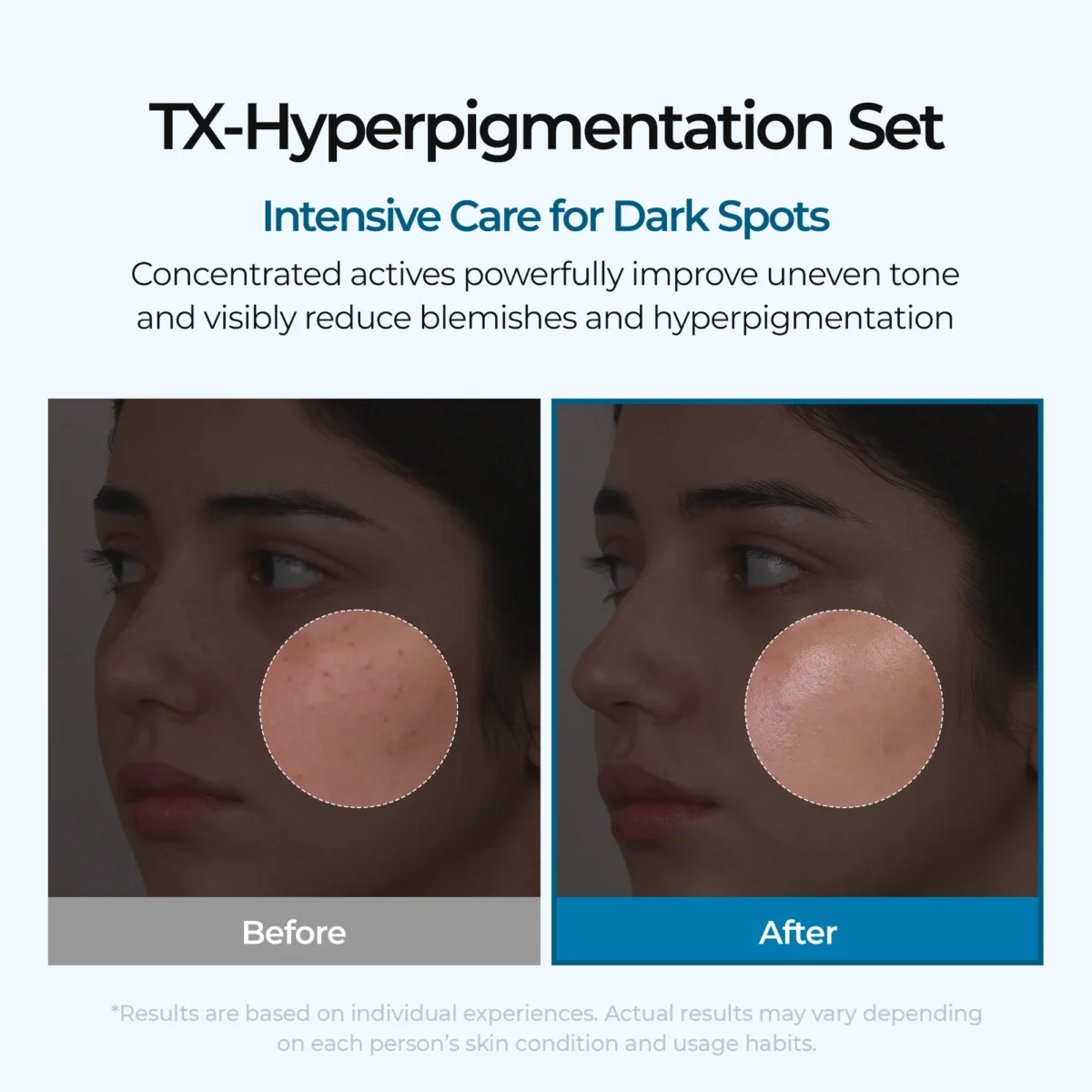 ست TXA اصلاح ملاسما و لک تیره دکتر ملاکسین Dr.Melaxin Dark Spot & Uneven Tone Peel Shot TX Duo - Image 6