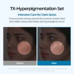 ست TXA اصلاح ملاسما و لک تیره دکتر ملاکسین Dr.Melaxin Dark Spot & Uneven Tone Peel Shot TX Duo - Image 6