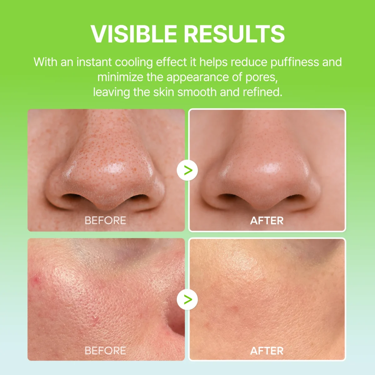 ست بالم کلسیوم و کاکتوس دکتر ملاکسین رفع منافذ و جوانساز Dr.Melaxin Cactox & Collagen Multi Pore Firming Balm Duo - Image 10