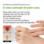 سرم لایه بردار صورت کاکتوس دکتر ملاکسین رفع منافذ باز Dr.Melaxin Peel Shot Exfoliating Cactox Serum - Image 6