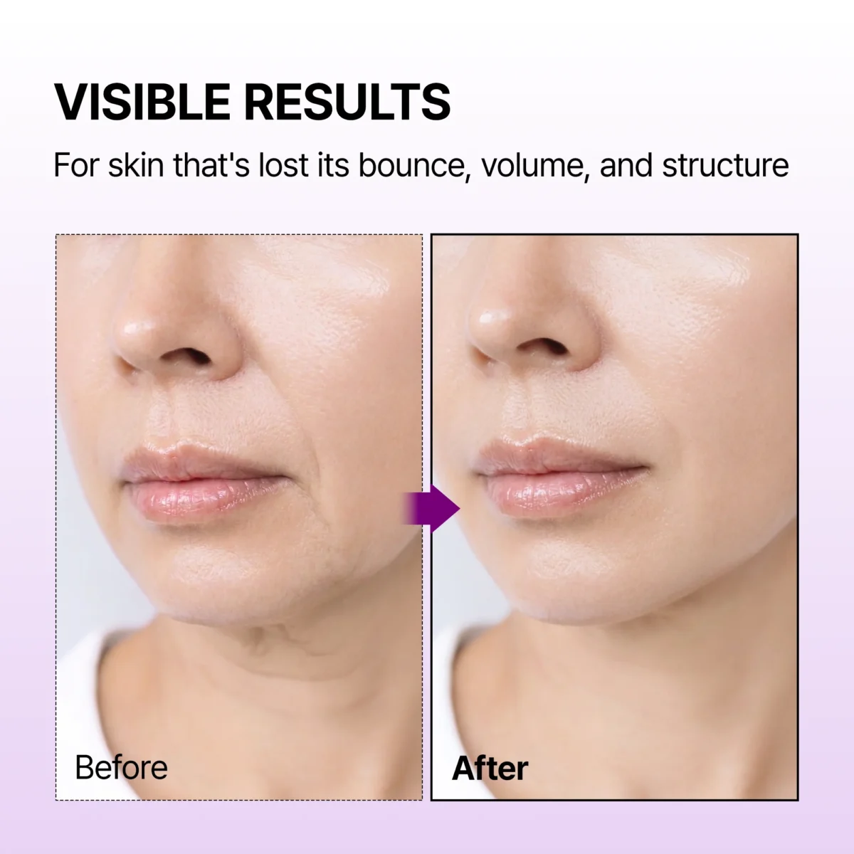 سرم کلسیوم باندیگ دکتر ملاکسین لیفتینگ فوری و سفت کننده پوست Dr.Melaxin Calcium Bonding Serum - Image 4
