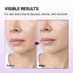 سرم کلسیوم باندیگ دکتر ملاکسین لیفتینگ فوری و سفت کننده پوست Dr.Melaxin Calcium Bonding Serum - Image 4