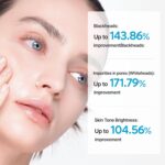 پیلینگ شات ترانزامیک اسید دکتر ملاکسین درخشان کننده و لایه بردار منافذ Dr.Melaxin Peel Shot Exfoliating TX Serum - Image 5