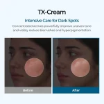 کرم TXA ضدلک و کک دکتر ملاکسین DR.Melaxin TX Tranexamic Acid CREAM - تصویر 4