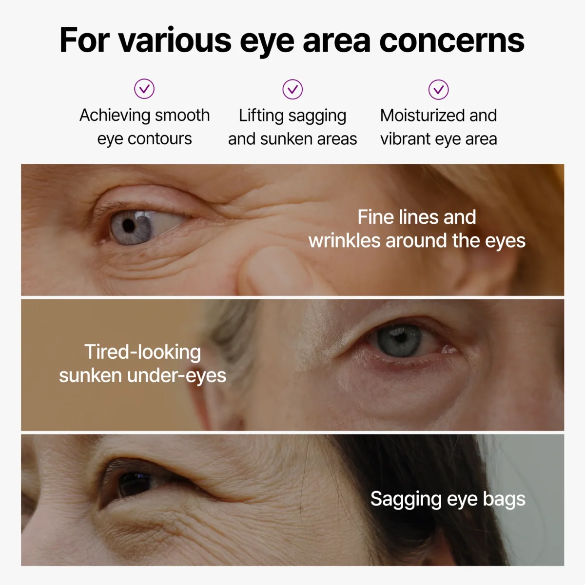 کرم دور چشم کلسیوم باندینگ دکتر ملاکسین رفع گودی و چروک عمیق Dr.Melaxin Calcium Bonding Eye Cream - Image 5