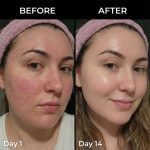 بالم استیکی PDRN و کلاژن مدی‌کیوب حجم‌دهنده، ضدچروک و سفت‌کننده پوست MEDICUBE PDRN Pink Collagen Volume Multi Balm - Image 2