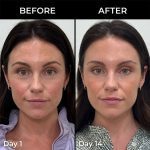 بالم استیکی PDRN و کلاژن مدی‌کیوب حجم‌دهنده، ضدچروک و سفت‌کننده پوست MEDICUBE PDRN Pink Collagen Volume Multi Balm