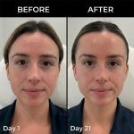 بالم استیکی PDRN و کلاژن مدی‌کیوب حجم‌دهنده، ضدچروک و سفت‌کننده پوست MEDICUBE PDRN Pink Collagen Volume Multi Balm - Image 13