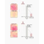 کرم PDRN ترمیم و تقویت کننده اسکین 1004 سنتلا SKIN 1004 PDRN 1.5 Cream Intensive Barrier Cream - Image 5