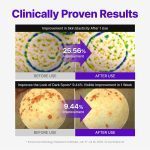 کرم PDRN مادکا سنتلیان 24 ترمیم‌کننده، سفت‌کننده و بازسازی‌ پوست CENTELLIAN24 Expert Madeca Cream Active Renew PDRN - Image 4