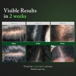 اسکالپ محرک رشد مو رزماری آروماتیکا AROMATICA Overnight Rosemary PDRN Scalp Serum for Scalp Treatment - Image 4