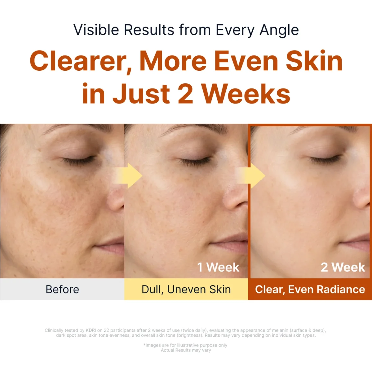 امپول کوجیک اسید و نیاسینامید سونگ بون ادیتور ضدلک و روشن‌کننده SUNGBOON EDITOR Kojic Acid Niacinamide Brightening Ampoule - Image 2