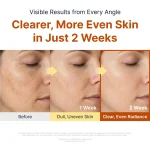 امپول کوجیک اسید و نیاسینامید سونگ بون ادیتور ضدلک و روشن‌کننده SUNGBOON EDITOR Kojic Acid Niacinamide Brightening Ampoule - Image 2