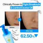 ست دابل کلینزینگ ضدجوش و التهاب نامبوزین Numbuzin Zero Blemish Double Cleansing - Image 8