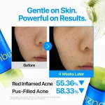 ست دابل کلینزینگ ضدجوش و التهاب نامبوزین Numbuzin Zero Blemish Double Cleansing - Image 3