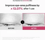 پچ هیدروژلی کلاژن و رتینول مدی‌ هیل چشم و صورت جوانساز و لیفتینگ MEDIHEAL COLLAGEN CAPSULE PATCH RETINOL - تصویر 4